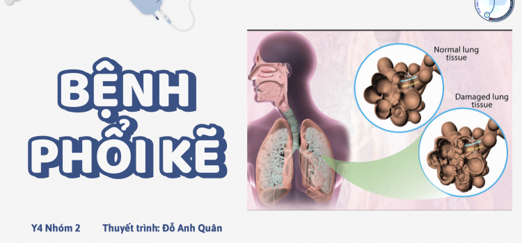 TIẾP CẬN CHẨN ĐOÁN VÀ ĐIỀU TRỊ BỆNH PHỔI KẼ