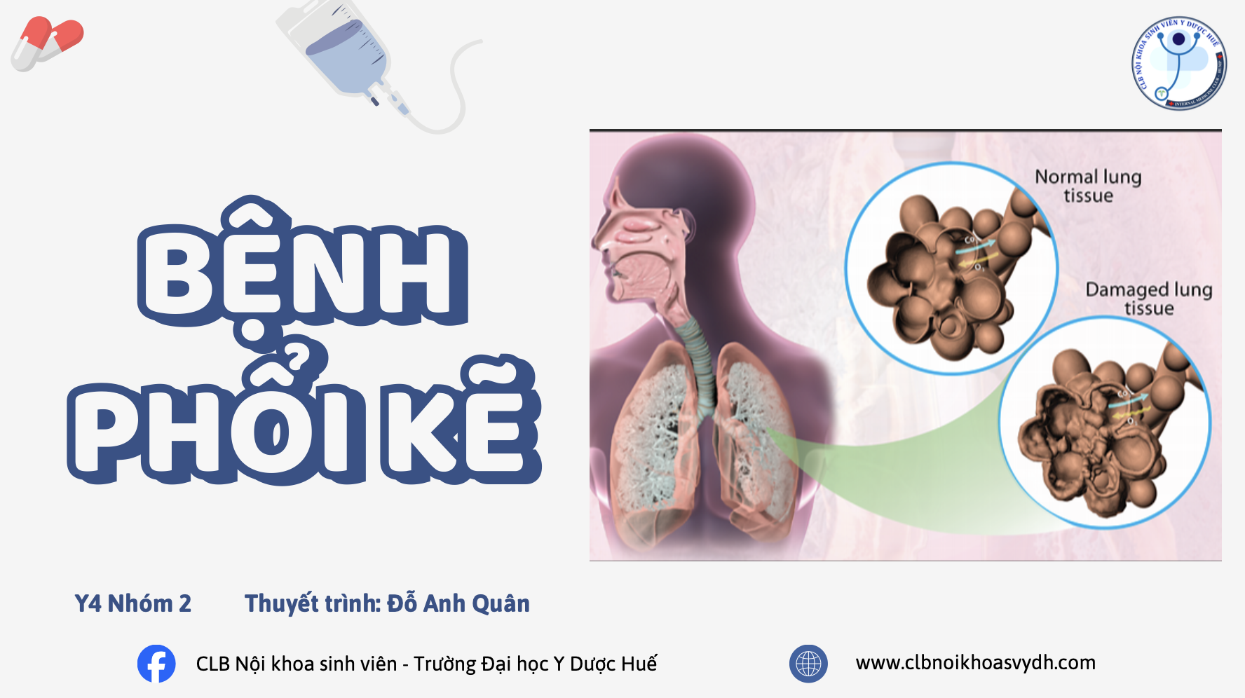 TIẾP CẬN CHẨN ĐOÁN VÀ ĐIỀU TRỊ BỆNH PHỔI KẼ